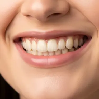 Düzgün bir gülümseme için ortodonti